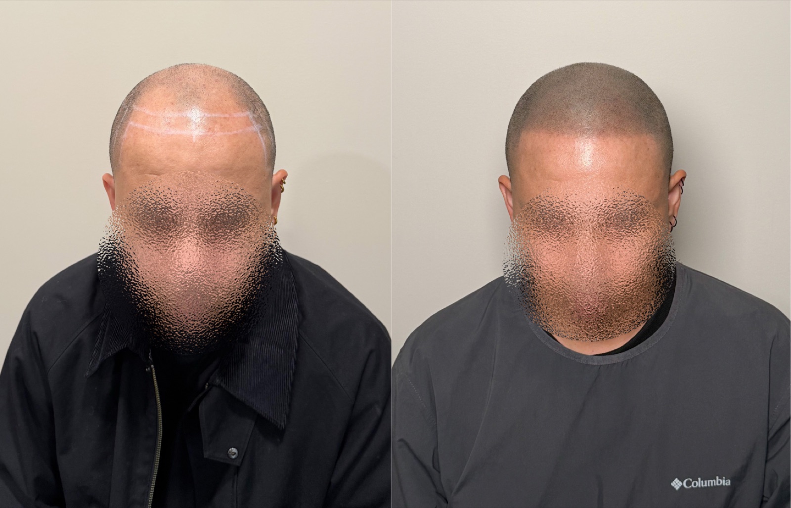 Shaved look SMP portfolio 13